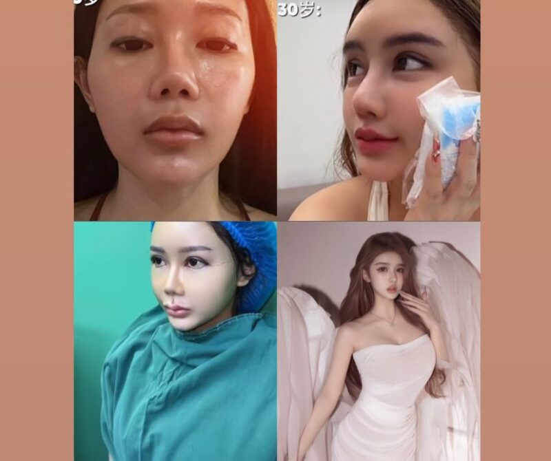 Hasil oplas BeYoung natural, elegan, dan anti gagal