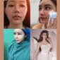 Hasil oplas BeYoung natural, elegan, dan anti gagal